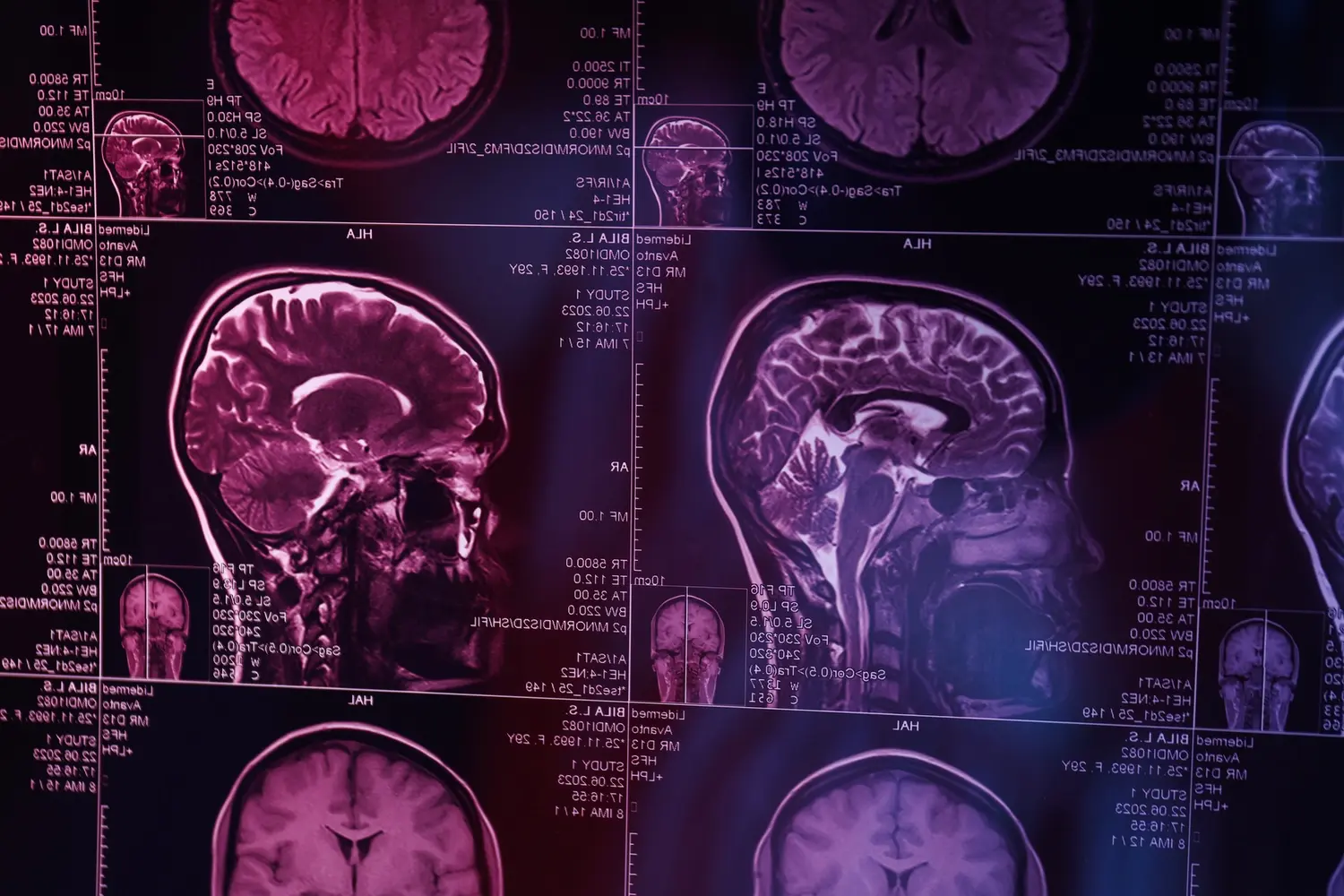 mri or magnetic resonance imaging of the head and utc